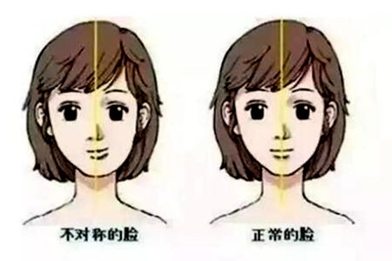 為什么左右臉不對(duì)稱,大小臉怎么糾正