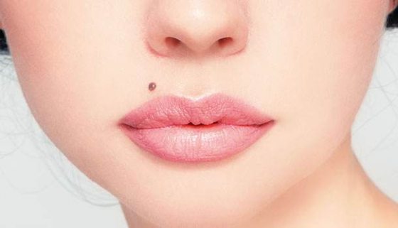 人為什么會(huì)長(zhǎng)痣,痣越來越多怎么辦